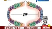 智齿又叫“立事牙”到底应不应该拔?资讯搜索最新资讯爱奇艺