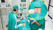 为什么医院做手术要用一块绿布盖着，通过一个孔手术？终于明白了