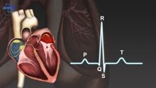 [图]动画演示：心电图的原理